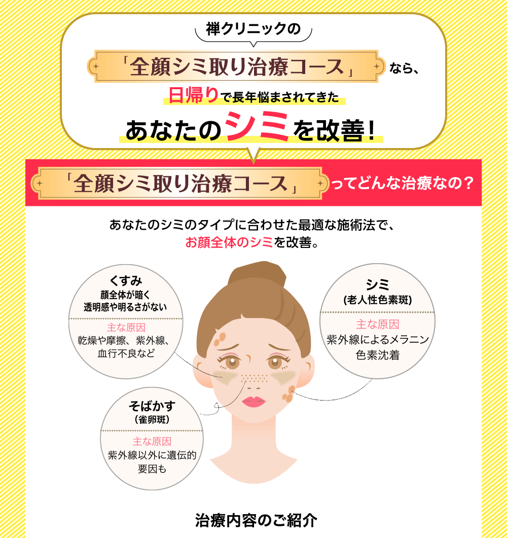 あなたのシミのタイプに合わせた最適な施術法