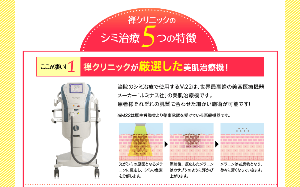 プラタナクリニックのシミ治療5つの特徴　世界最新式の美肌治療機！