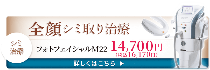 全顔シミ取り