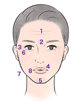 ボトックス注射で特に効果的な部位