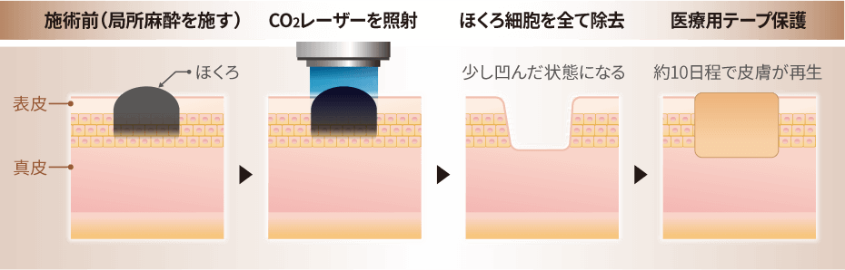 ヴェルヴェットスキン