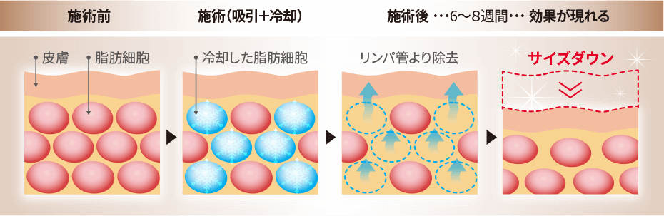 脂肪分解の仕組み