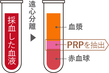 PRP図解